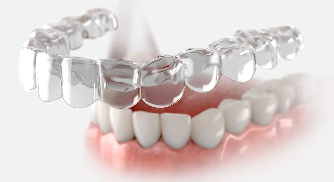 Prudentoe orthodontist providing clear aligner and Invisalign treatment for discreet teeth straightening at a patient's home in Hyderabad