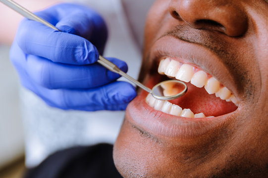 Prudentoe dentist performing a comprehensive dental check-up and oral health examination at a patient's home in Hyderabad
