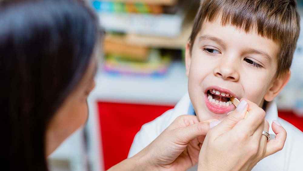Read more about the article How to treat tooth decay in children?