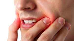 6 Home remedies for your Gum diseases