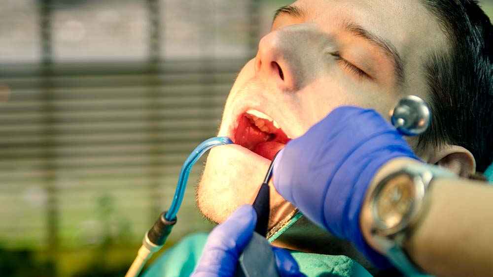 You are currently viewing How to handle dental emergencies – a quick guide