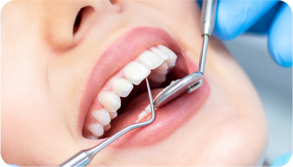 teeth-whitening-clinic-in-hyderabad