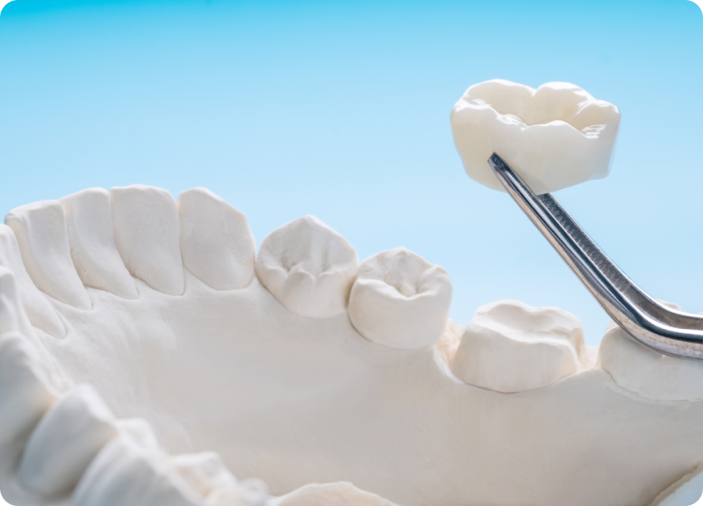 top-dental-hospitals-in-hyderabad