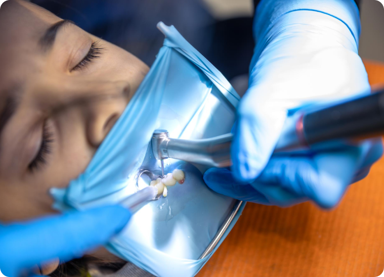 dental-implants-cost-in-hyderabad-india