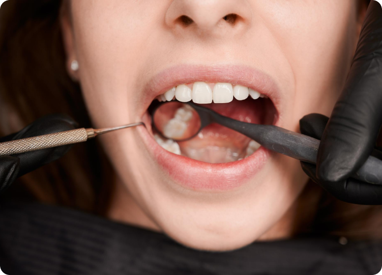dental-hyderabad