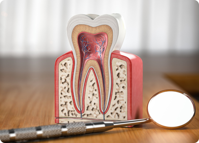 best-dental-implants-in-hyderabad