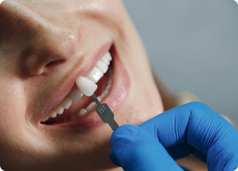 dentist-at-home-service