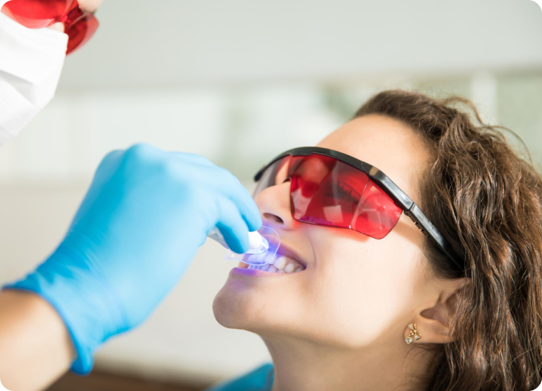 teeth-cleaning-cost-hyderabad